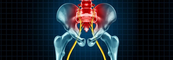 Chiropractic Care for Sciatica and Nerve Pain: A Clinically Oriented Guide in Hot Springs AR